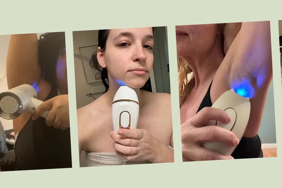 laser hair removal device users