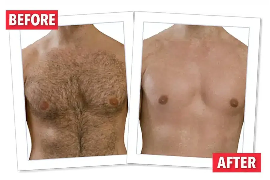 Proper application technique for hair removal cream on male chest hair