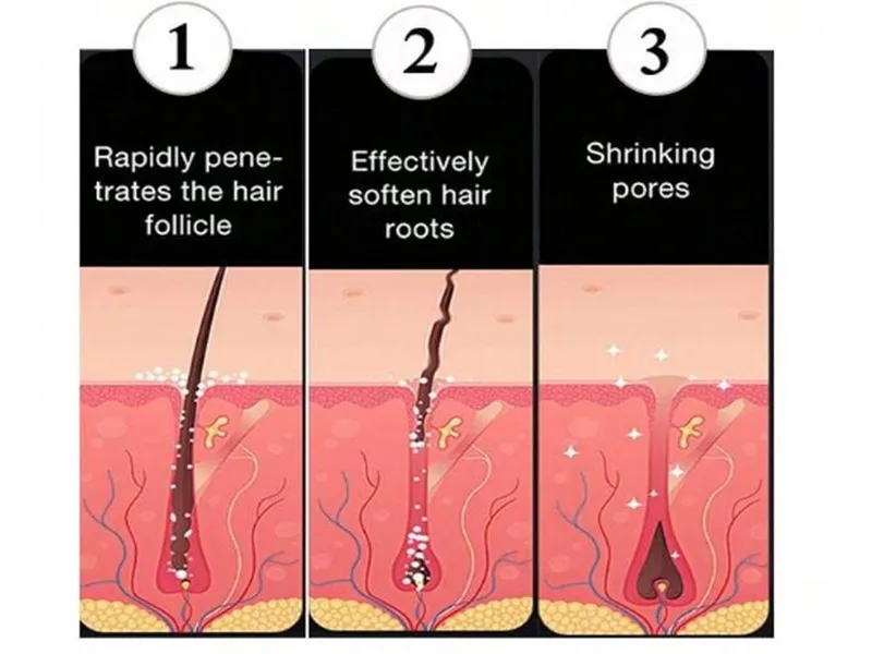 how depilatory creams work