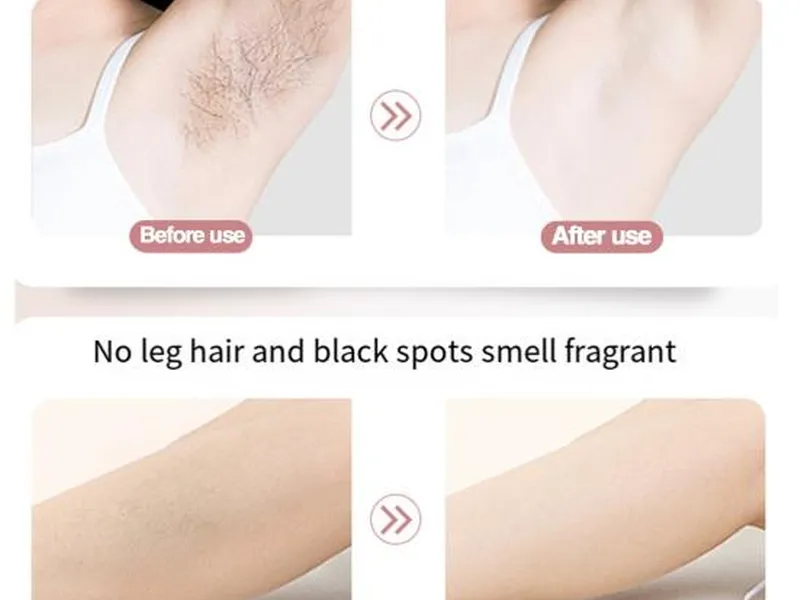 Safe and effective hair removal cream results for teenagers when proper techniques are followed