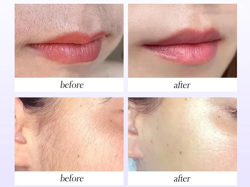 Flamingo facial hair removal cream - before and after