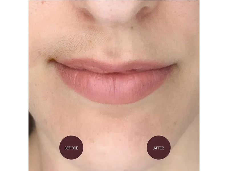 nads facial hair removal cream - before-after photo