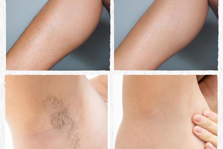 Neem & Fennel Depilatory Mask Hair Removal Powder - before and after